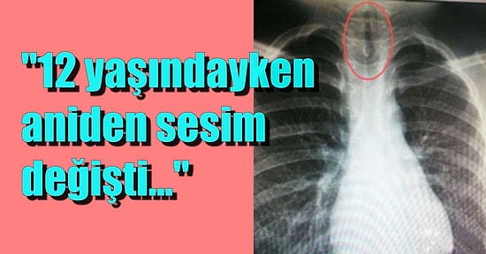 4. Evre Kanseri Yenerek Bu Hayata Tutunmak İçin Çok Fazla Sebep Olduğunu Gösteren Savaşçının Hikayesi!