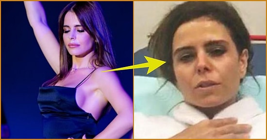 Gece Saatlerinde Apar Topar Hastaneye Kaldırılan Simge Sağın Takipçilerini Uyardı: Lütfen Sağlığınıza Dikkat Edin...