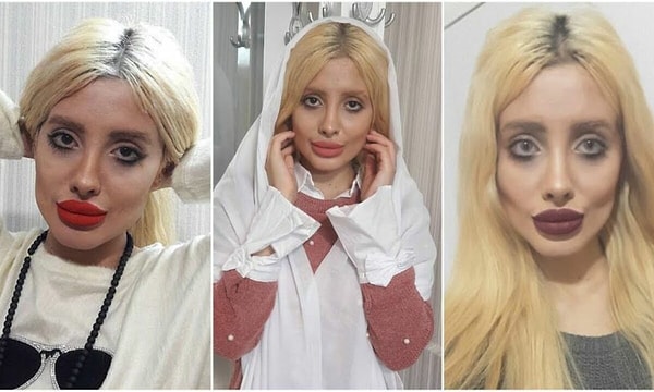 Однако Табар призналась, что делала пластическую операцию на носу и губах, а также удаляла комки биша.