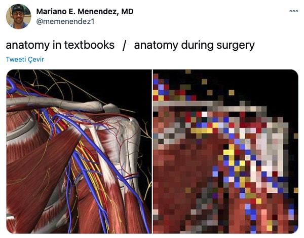 14. "Ders kitaplarında anatomi     /    Ameliyat sırasında anatomi"