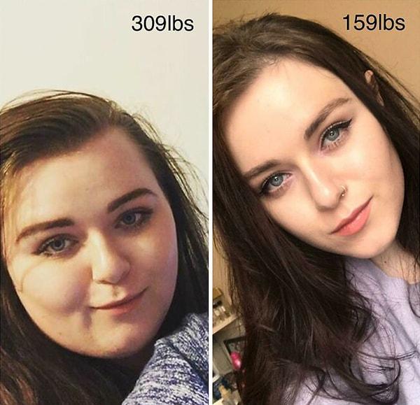 29. "140 kilodan 72 kiloya. Yüzümün değişimine bakın..."