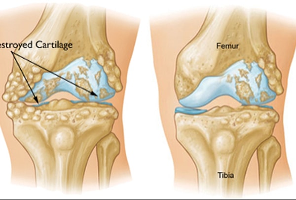 8. Одно из самых скользких веществ на планете - синовиальная жидкость, находящаяся в нашем колене.