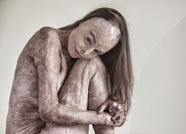 1. Кожа, в которой я живу