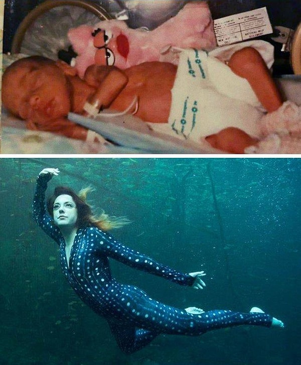 15. "Я родилась на 6-м месяце. Никто не верил, что я выживу, а я смогла!"