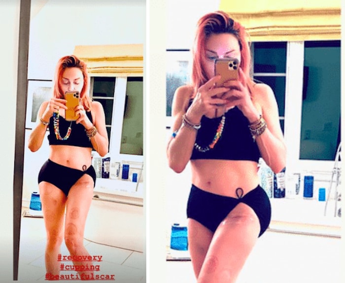 Мадонна поделилась в Instagram кадрами, демонстрирующими не только ее впечатляющий пресс, но и шрам после операции на бедре