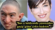 Toplum ve Ailesi Tarafından Dışlanan 'Çirkin' Bir Kadının Size İlham Olabileceğini Düşündüğüm Dönüşüm Hikayesi