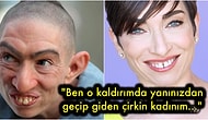 Toplum ve Ailesi Tarafından Dışlanan 'Çirkin' Bir Kadının Size İlham Olabileceğini Düşündüğüm Dönüşüm Hikayesi