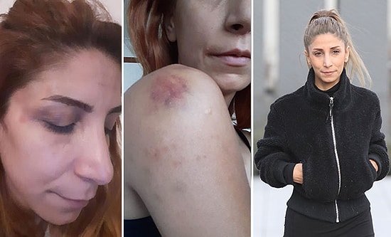 Sevgilisi Tarafından Aylarca Darp Edilen Genç Kadın: 'Gördüğüm İşkence Sadistlik Boyutundaydı'