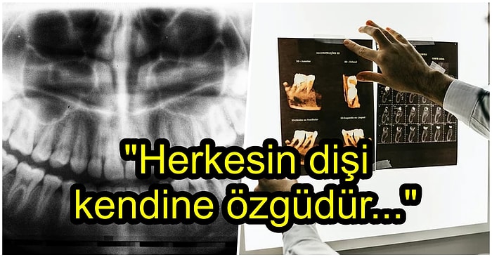 Kimliği Bilinmeyen Cesetler Diş Kayıtlarından Nasıl Tespit Edilir?