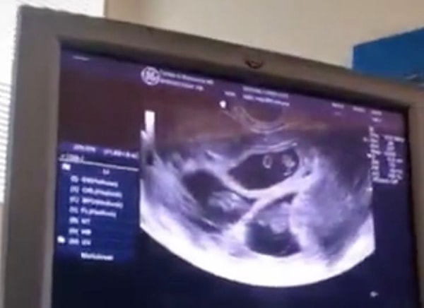 «Все три моих ребенка прошли анализ ДНК. Все они от одного отца».