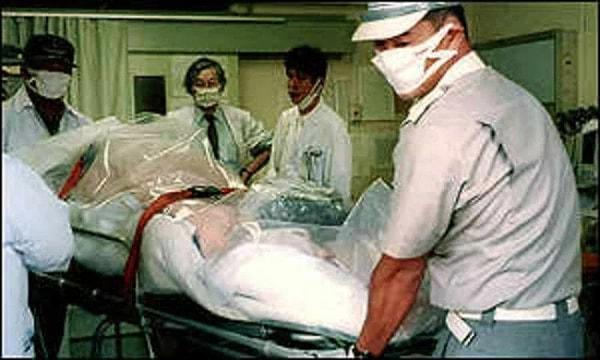 Kazadan sonra tam 667 kişi akut radyasyon zehirlenmesine bağlı olarak yaşamını yitirdi, fakat onlar arasında çok şanssız olan biri vardı.