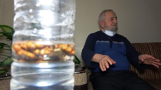 Koronavirüsten Şüphelenildi, Akciğerinden Ceviz Çıktı