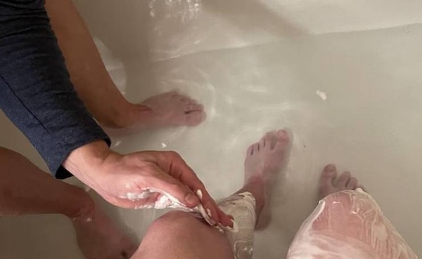 9. "После операции я чувствовала себя ужасно и не хотела заниматься собой. И тут мой муж решил подбодрить меня и побрил мне ноги. Это мотивировало меня на то, чтобы наконец вылезти из кровати и начать жить дальше. Люблю его всем сердцем".