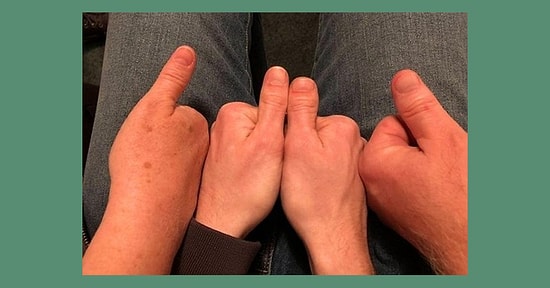 Vücudunda Olan Bir Genetik Farklılığı Bizimle Paylaş, İçeriğini Yapalım!