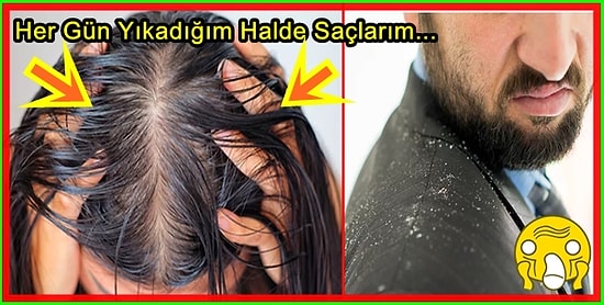 Saç Sorunlarını Kökten Uca Çözüp Daha Sağlıklı ve Işıltılı Saçlara Kavuşmanı Sağlayacak Taktikler