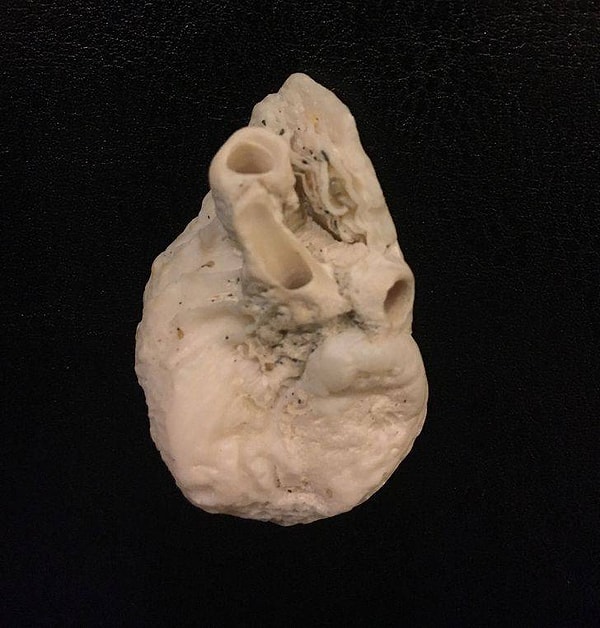 15. "Морская ракушка, напоминающая человеческое сердце".