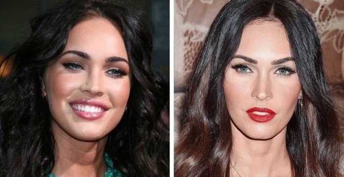 17 селебрити, которые избавились от своих пухлых щечек