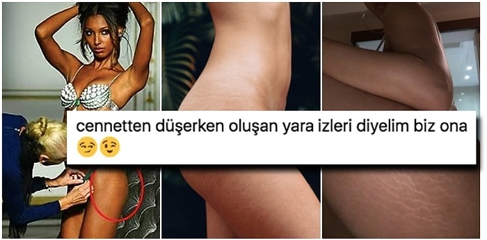 Kadınların Kalça ve Karın Çatlaklarıyla İlgili Tartışmaya Son Noktayı Koyarak Herkesi Susturan Yorumlar