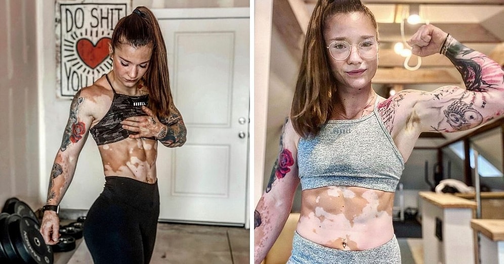 Фитнес и тяжелая атлетика помогли девушке с витилиго принять свою болезнь