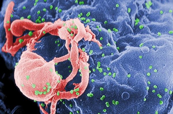 10. "AIDS nedir ve AIDS, HIV'den farklı mıdır?"