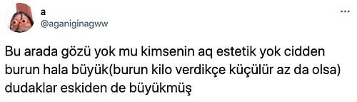 Değişimiyle Herkesi Şaşırtan Damla Ersubaşı Hiç Estetiği Olmadığını Söyleyince Tartışma Yarattı