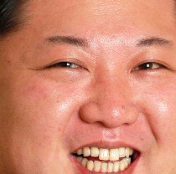Kim JongUn