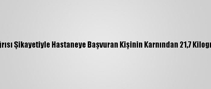 Etiyopya'da Karın Ağrısı Şikayetiyle Hastaneye Başvuran Kişinin Karnından 21,7 Kilogram Tümör Çıkarıldı