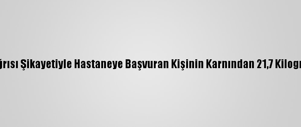 Etiyopya'da Karın Ağrısı Şikayetiyle Hastaneye Başvuran Kişinin Karnından 21,7 Kilogram Tümör Çıkarıldı