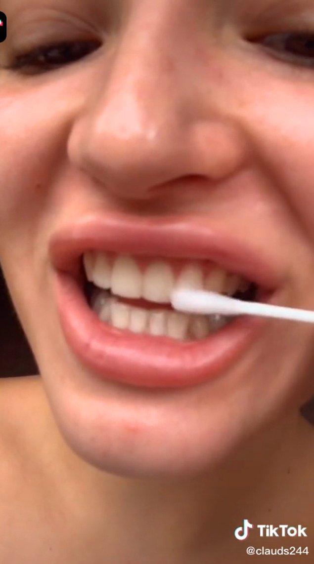 6. Hidrojen peroksit ve hatta çamaşır suyuyla yapılan evde diş beyazlatma yöntemi de çok riskli.