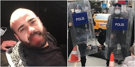 Ankara'da Boğaziçi'ne Destek Protestosuna Müdahale: Polis Bir Kişinin Dişini Kırdı, Gözaltılar Var...