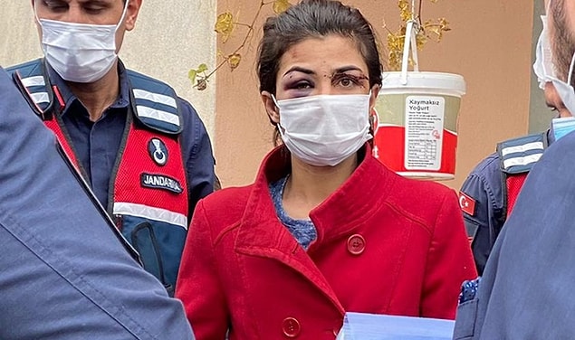 'Meşru müdafaa değil'
