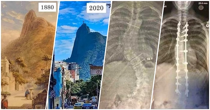 Şaşkınlıktan Neye Uğradığınızı Anlayamayacağınız 'Öncesi ve Sonrası' Temalı 21 Fotoğraf