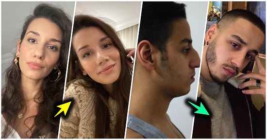 Burun Ameliyatı Olup Öncesi ve Sonrası Fotoğraflarını Paylaşırken Değişimleriyle Herkesi Şaşırtan 15 Kişi