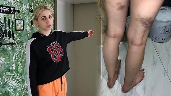 Gizem Avcı'nın Yaşadığı Dehşet: 'Ziyarete Gittiğimizde Annemin Sevgilisi Taciz ve Darp Etti'