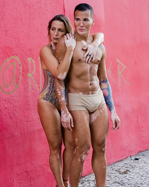 Узнав, что его история вдохновила мальчика перестать скрывать свою кожу косметикой и помог другой девушке бороться с депрессией, он решил опубликовать больше фотографий.