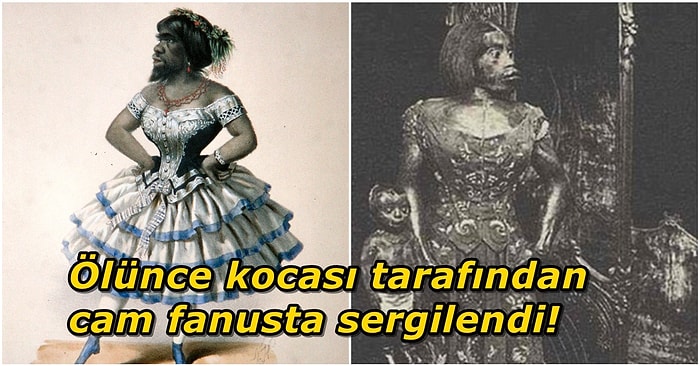 Rahatsızlığı Nedeniyle Tüm Vücudu Kıllarla Kaplı Olan Julia Pastrana ve Yaşadığı Zorlu Hayat