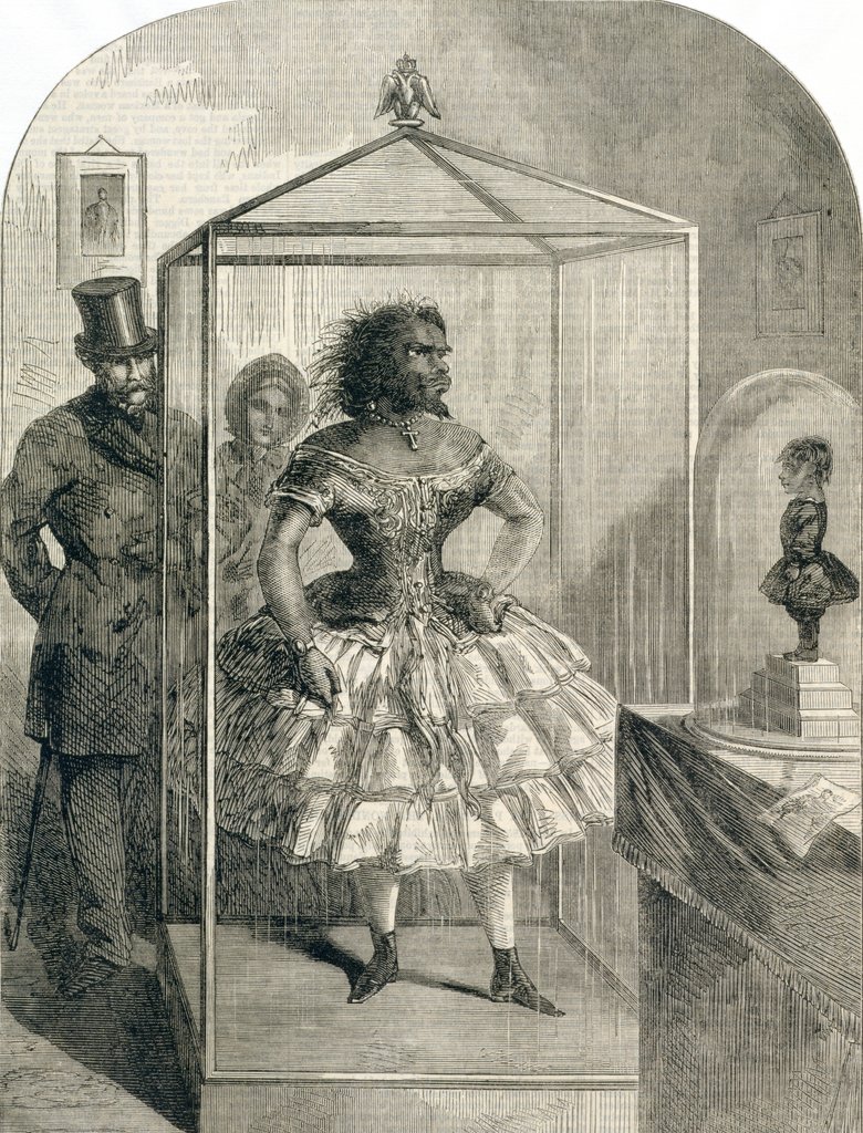 Rahatsızlığı Nedeniyle Tüm Vücudu Kıllarla Kaplı Olan