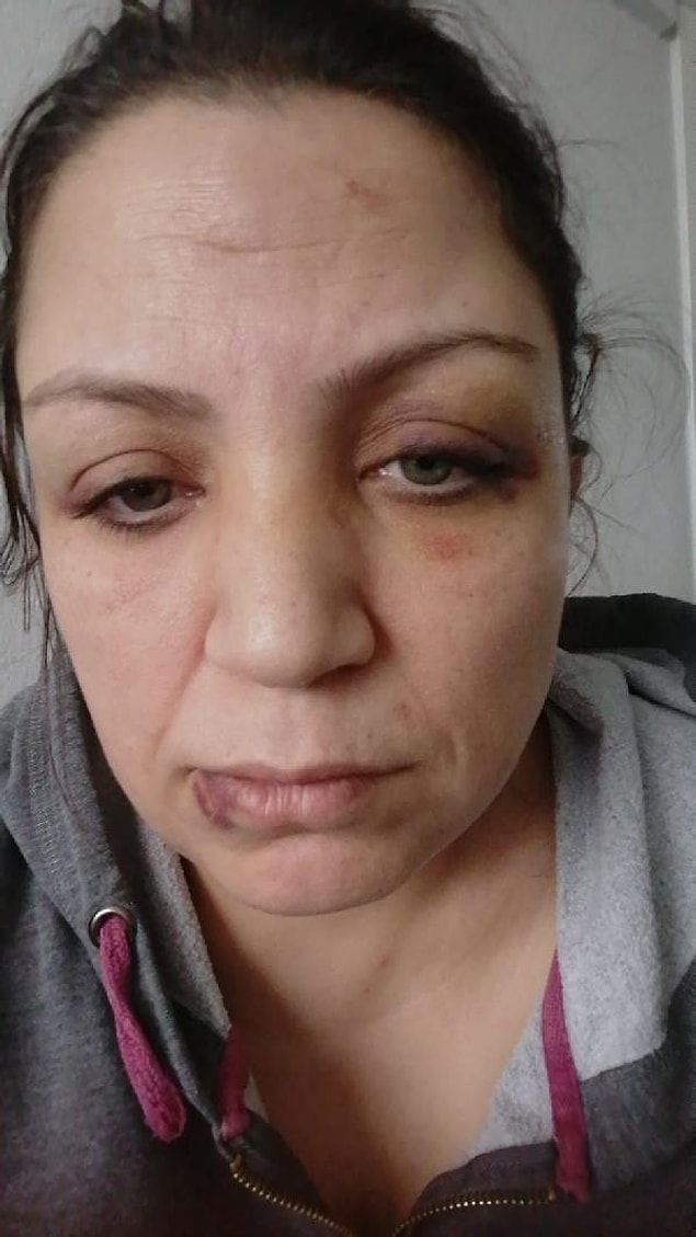 Darp raporu alarak şikayetçi oldu
