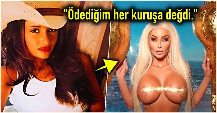 Barbie'ye Benzemek İçin Vajinası da Dahil Yaptırdığı Tüm Estetik Operasyonlara 1 Milyon Dolar Harcayan Kadın