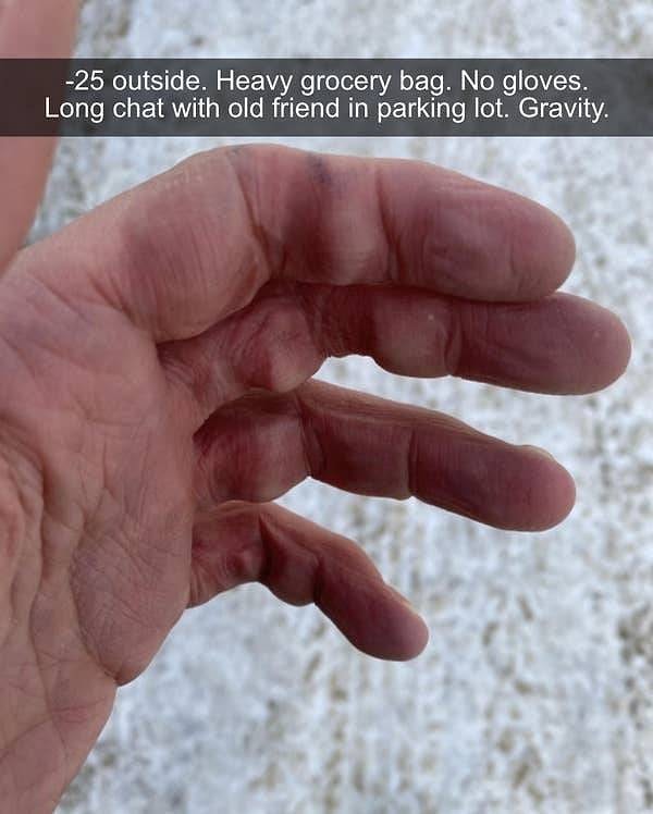 14. "На улице мороз 25 градусов. Тяжелый пакет с продуктами. Нет перчаток. Долгая болтовня со старым другом на парковке. Гравитация. И вот результат:"