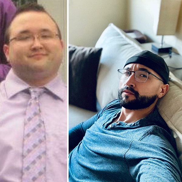 2. 23 года и 31. Скинул 73 кг 7 лет назад. Мои волосы переместились с макушки на лицо :D