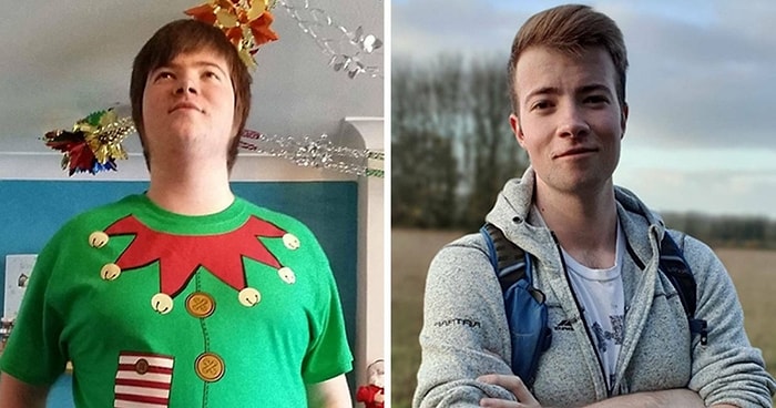 10 гадких утят, которые делятся своими невероятными превращениями в прекрасных лебедей