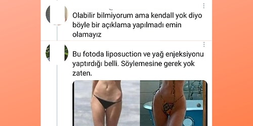 Kendall Jenner'ın Vücuduyla İlgili Birbirlerine Kafa Tutan Estetik Doktoru ve Bir Kullanıcının Diyalogu