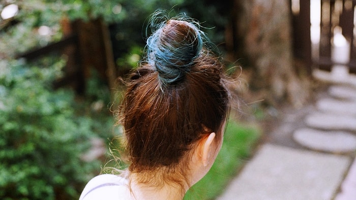 'Rapunzel Sendromlu' Kadının Midesi Yırtıldı: Karnından 48 Cm Büyüklüğünde Saç Yumağı Çıkartıldı