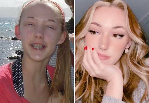 2. Покрасила волосы, открыла глаза, добавила брови ... (13 лет /21 год)