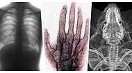 İlk Bakışta Ne Olduğuna Anlam Veremeyip Derin Düşüncelere Dalacağınız Birbirinden Enteresan X-Ray Görüntüleri
