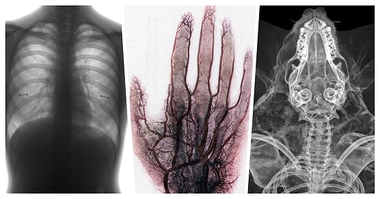 İlk Bakışta Ne Olduğuna Anlam Veremeyip Derin Düşüncelere Dalacağınız Birbirinden Enteresan X-Ray Görüntüleri