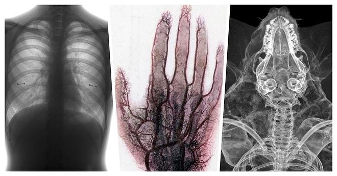 İlk Bakışta Ne Olduğuna Anlam Veremeyip Derin Düşüncelere Dalacağınız Birbirinden Enteresan X-Ray Görüntüleri