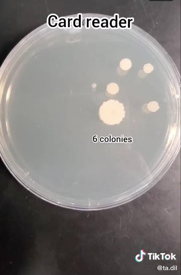 Pos cihazı: 6 bakteri kolonisi