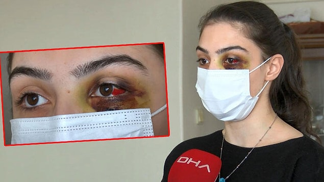 "Daha önce bıçakla saldırdı"
